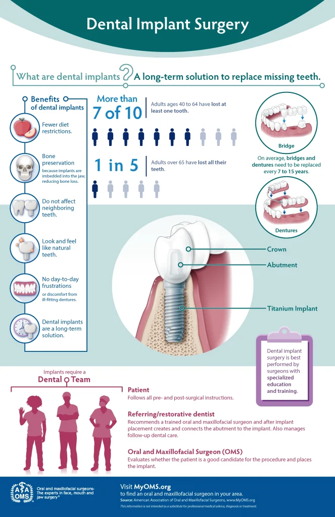 Dental Implant Surgery